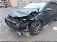 2017; 2л; Бензин; Инжектор; Седан; черный; США; разб. номер L574 #13