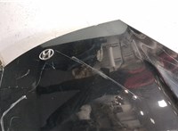 986302C700 Форсунка омывателя стекла Hyundai Coupe (Tiburon) 2002-2009 11361789 #7