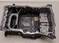 215202F000, 215102F000 Поддон KIA Sorento 2009-2014 20334890 #5