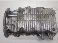  Поддон Hyundai Tucson 1 2004-2009 20417556 #1