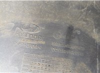  Бампер Hyundai Santa Fe 2000-2005 20424300 #5