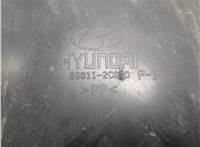  Защита арок (подкрылок) Hyundai Coupe (Tiburon) 2002-2009 9378959 #3