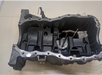 8200238932 Поддон Renault Megane 2 2002-2009 20018546 #3