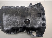  Поддон Renault Laguna 2 2001-2007 20018969 #1