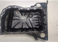  Поддон Renault Laguna 2 2001-2007 20018969 #2