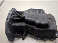 Поддон Renault Scenic 2009-2012 20140744 #1