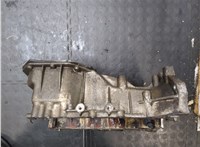 215102B000, 266112B000, 266122B000 Поддон KIA Ceed 2007-2012 20185923 #2